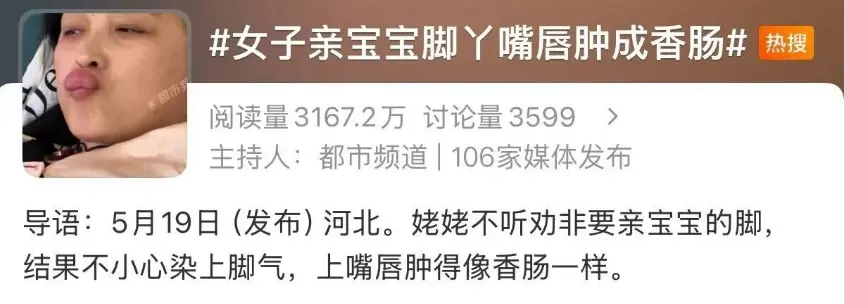 姥姥不听劝亲吻婴儿脚丫 染上脚气 嘴唇红肿如香肠